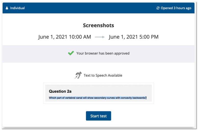 A screenshot showing where you see that Inspera's own text-to-speech is enabled